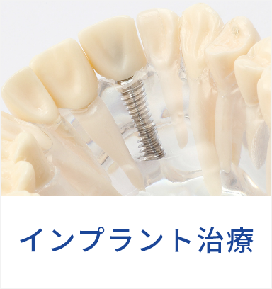 インプラント治療